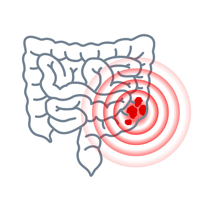 panitumumab colorectal cancer